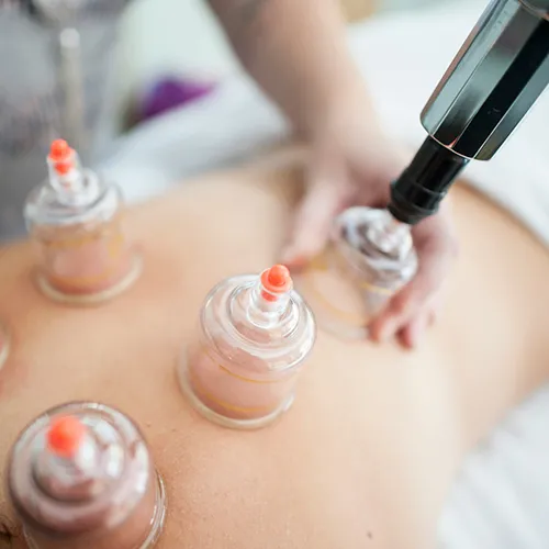 Cupping & Geavanceerde Stretching Massage